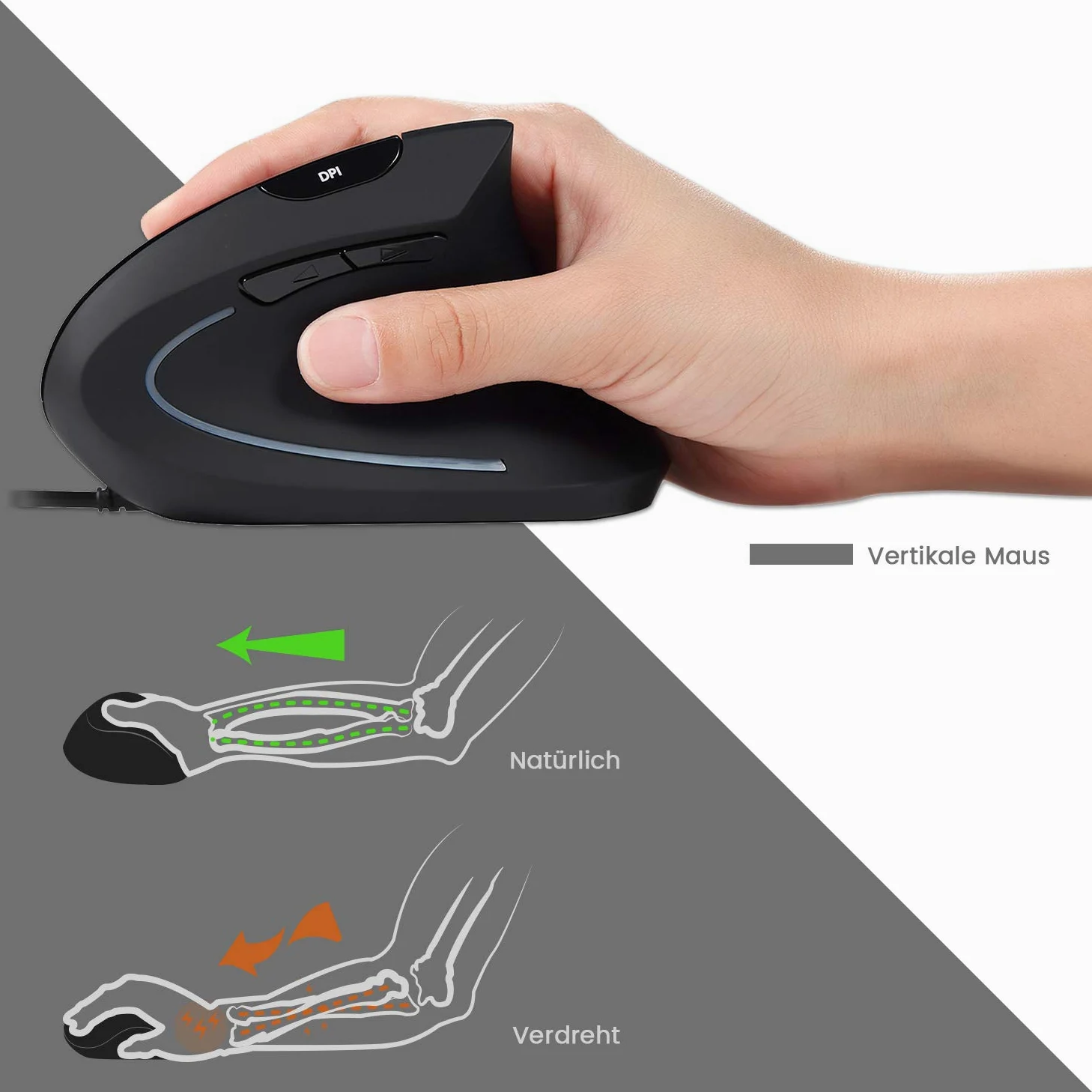 Perixx Periduo-505 - Tastiera ergonomica con mouse verticale, tastiera divisa, rotella di scorrimento a 4 vie, poggiapolsi personalizzabile, tasti piatti, con cavo USB, QWERTZ