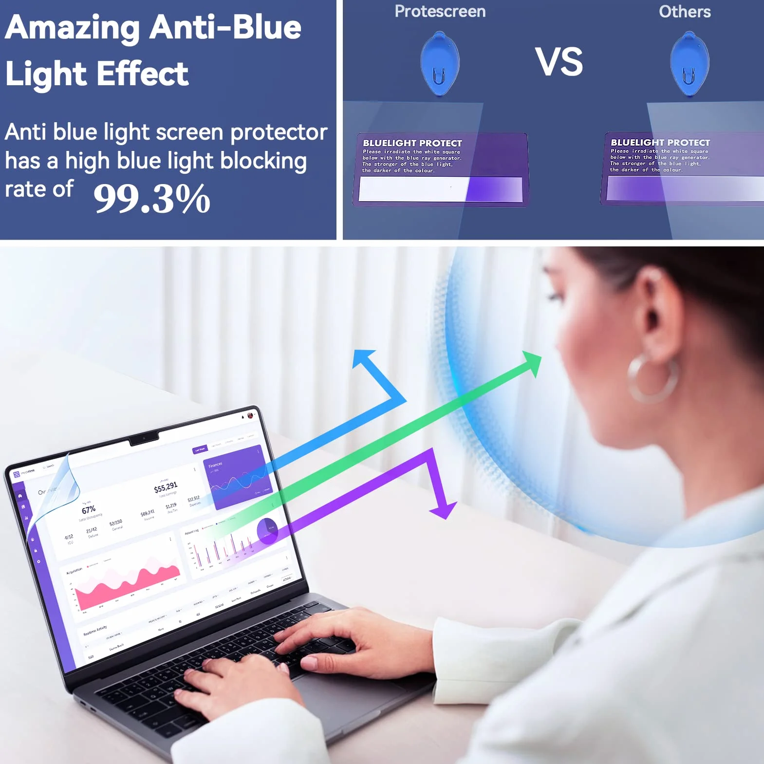 Pellicola Protettiva Anti Luce Blu per MacBook Pro 14 (2021-2024 M1 M2 M3 M4) 2 Pezzi Antigraffio